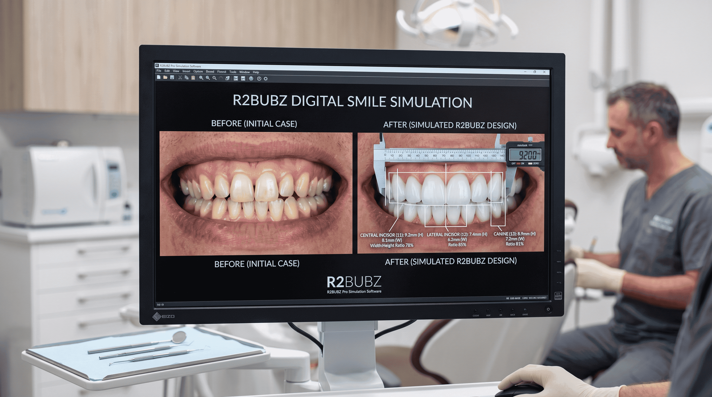 Digital Smile Design in clinic